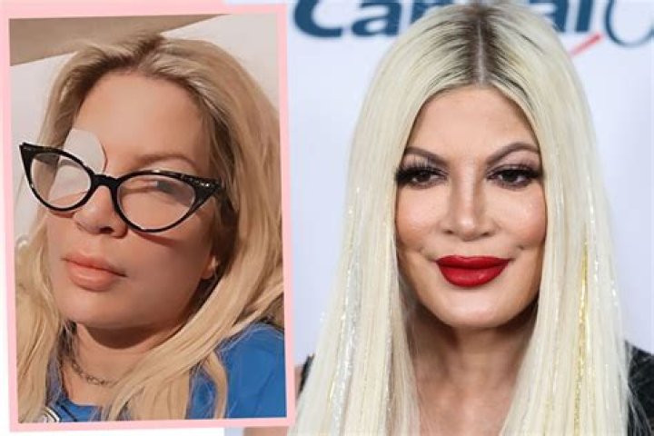 Annabella Sciorra's Plastic Surgery: Before and After