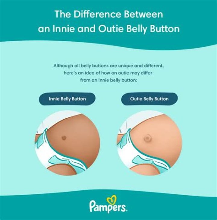 Belly Ring Outie: Understanding, Care, and Trends