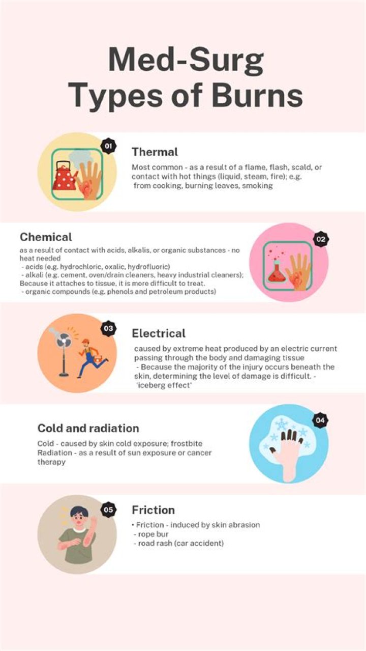 Burns NC State: A Comprehensive Guide to Understanding the Importance of Burns in North Carolina State University
