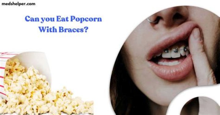Can You Eat Popcorn with Braces? The Ultimate Guide