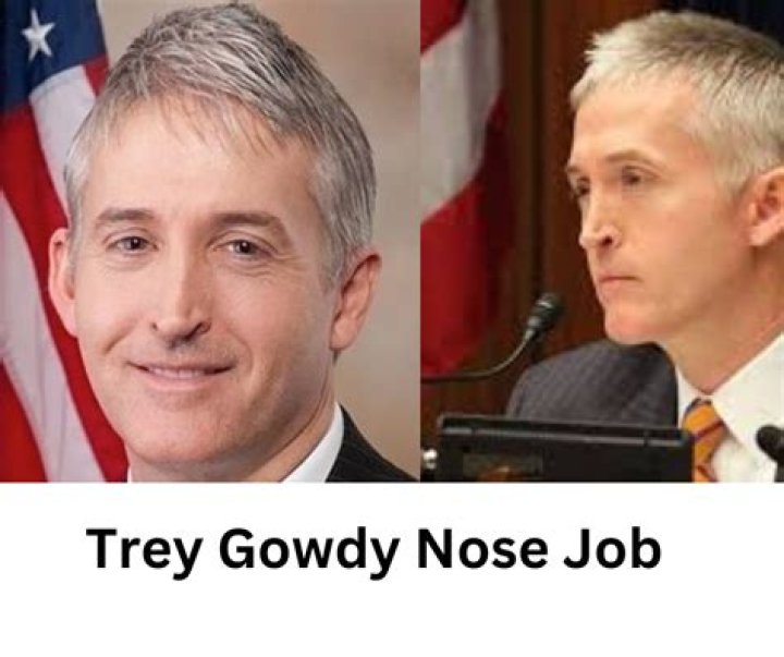 Did Trey Gowdy Have a Nose Job? Uncovering the Truth Behind His Transformation