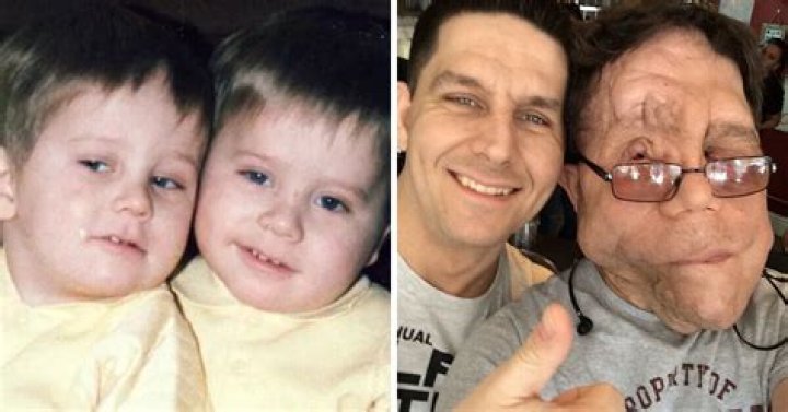 Discovering the Unique Journey of Adam Pearson