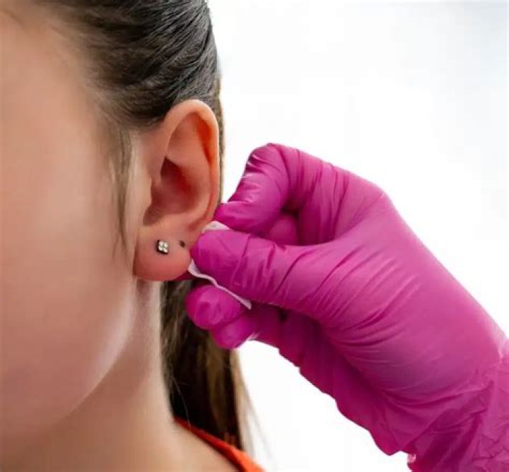 Earring Back Stuck in Earlobe: Causes, Solutions, and Prevention