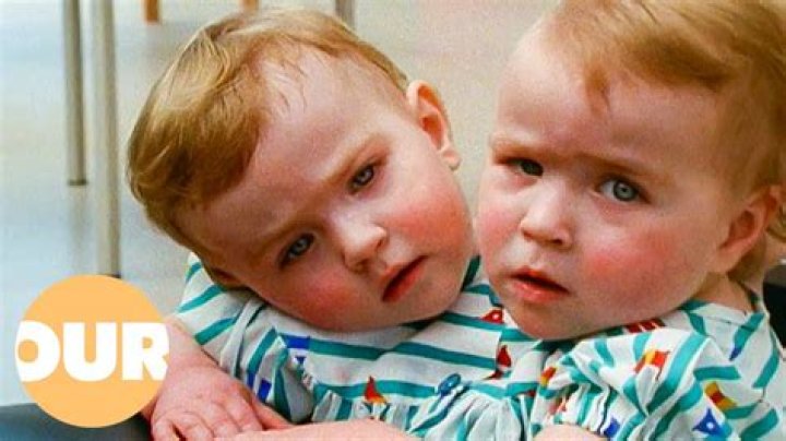 Eilish Holton Twin Today: Unraveling the Fascinating Story