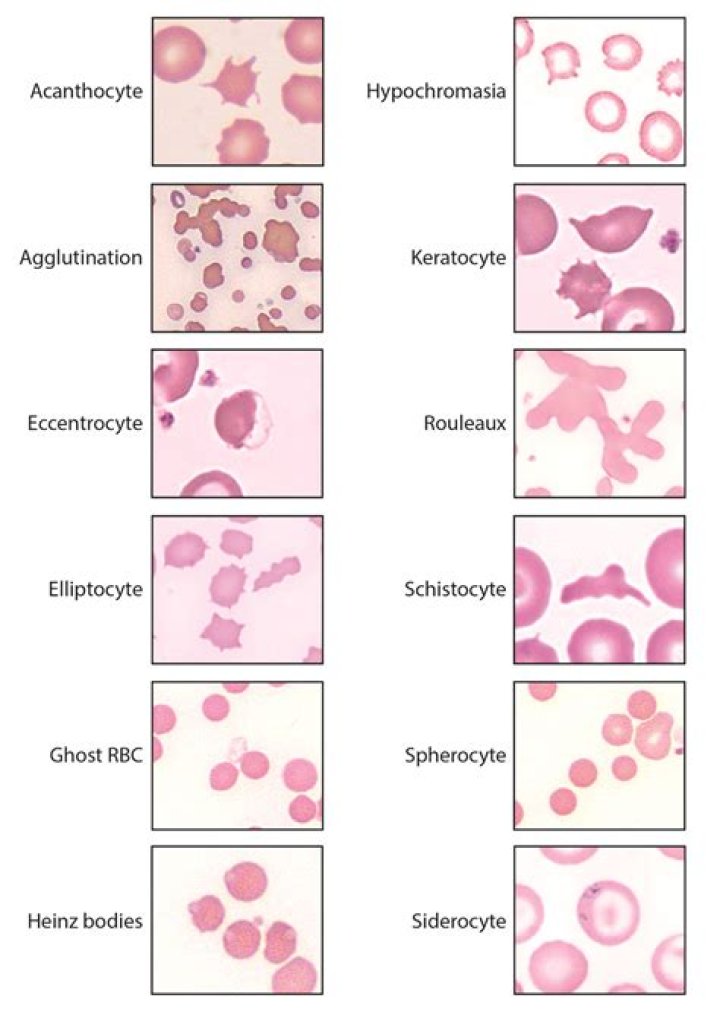 Essential Insight into Eccentrocytes: A Comprehensive Examination