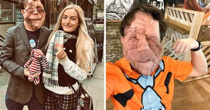 Exploring Adam Pearson's Personal Life: Who is His Wife?