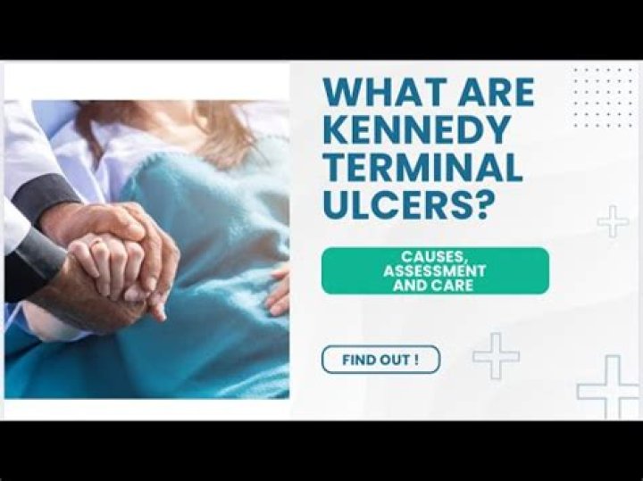 Exploring Kennedy Ulcer Pictures: Understanding and Awareness