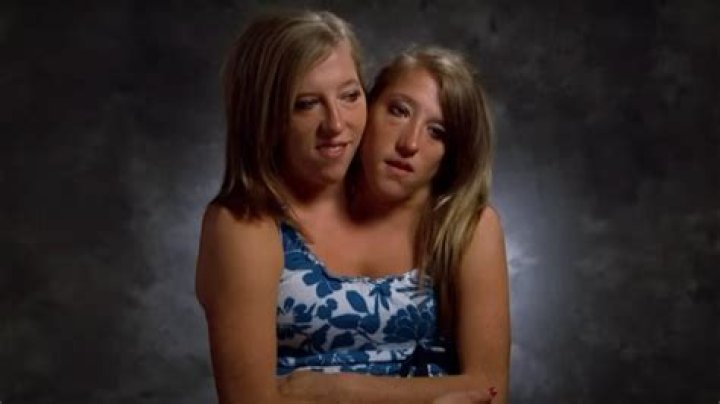 Exploring the Fascinating World of Abby and Brittany Hensel: A Photo Journey
