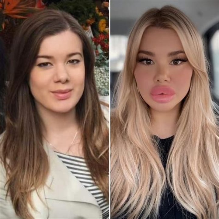 Exploring the Reddit Bimbofication Phenomenon: Understanding Trends and Impacts