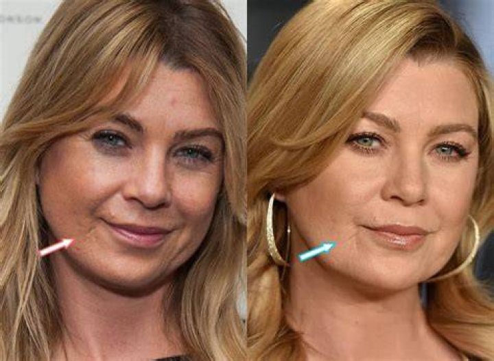 Has Ellen Pompeo Had Plastic Surgery? A Comprehensive Analysis