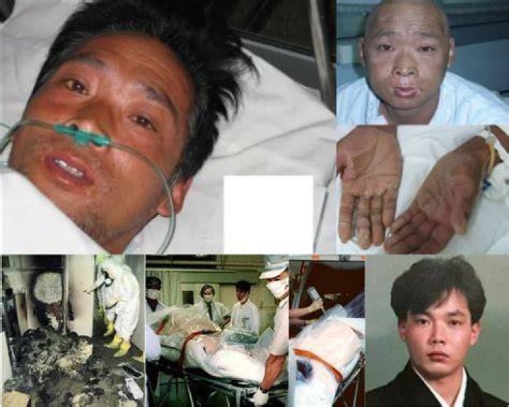 Hisashi Ouchi Real Images: A Tragic Tale of Radiation Exposure