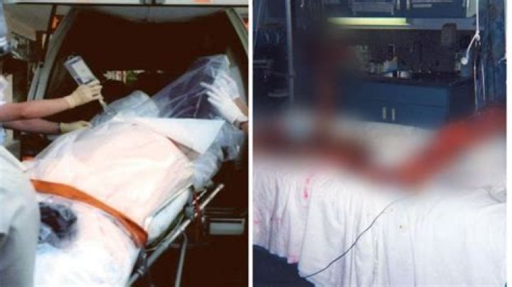 Hisashi Ouchi: The Tragic Story of a Radiation Victim