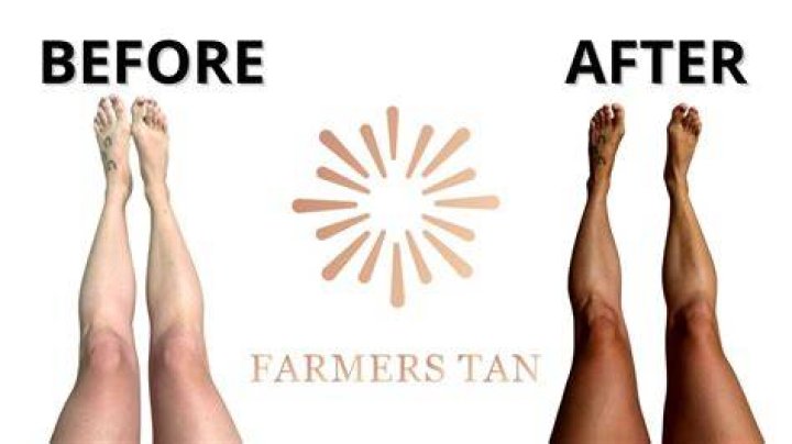How to Get Rid of Farmers Tan: Effective Solutions for a Smooth and Even Skin Tone