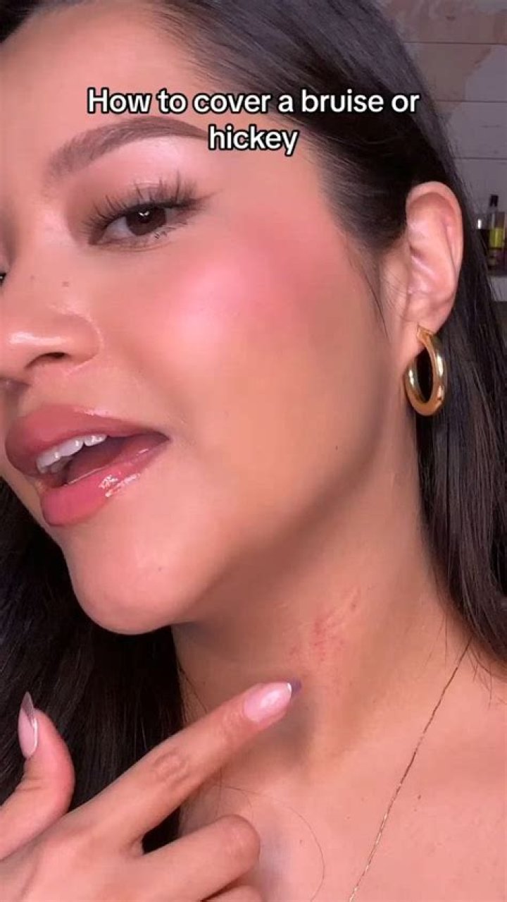 How to Hide a Hickey: Effective Techniques and Tips