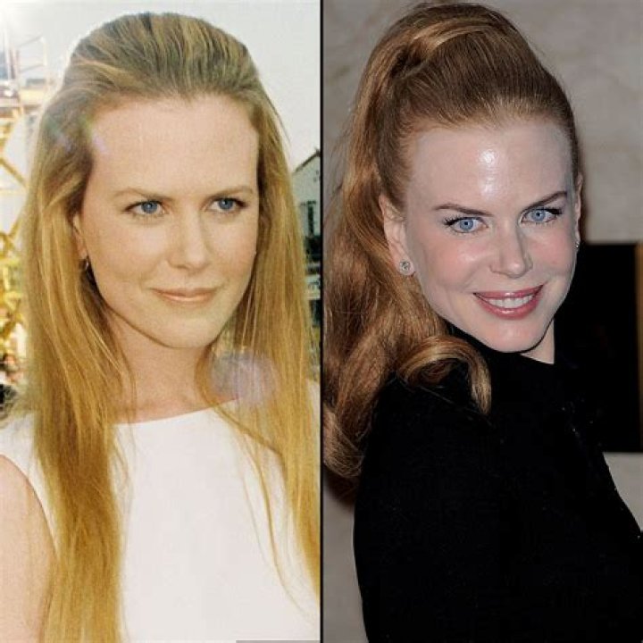Is It True: Nicole Kidman's Secret to Ageless Beauty
