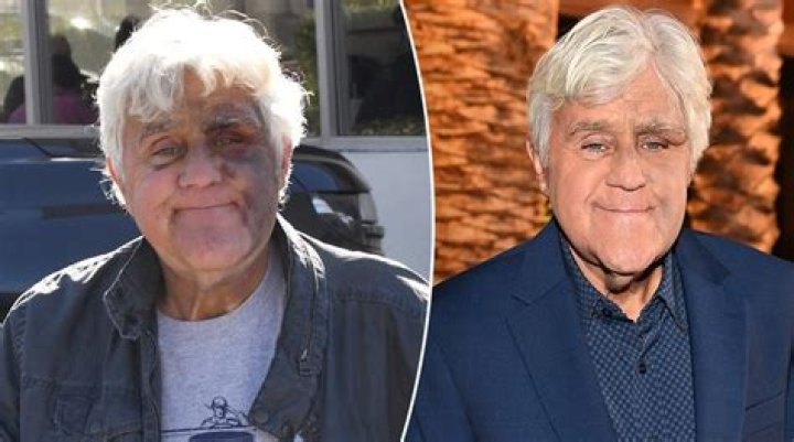 Is Jay Leno Dead? The Truth Behind the Rumors