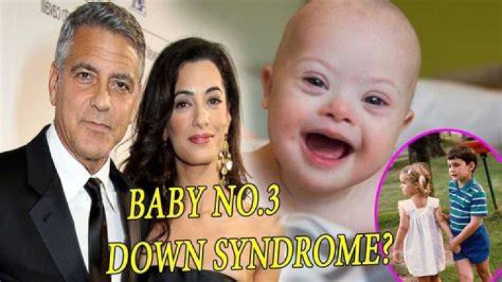 Is One of George Clooney's Twins Suffering from Down Syndrome? An Uncovered Truth