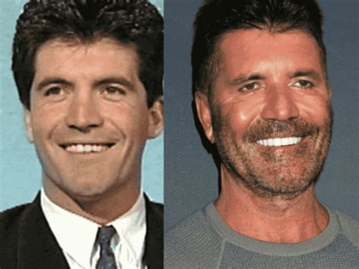 Is Simon Cowell Alive? A Comprehensive Look at His Life and Career