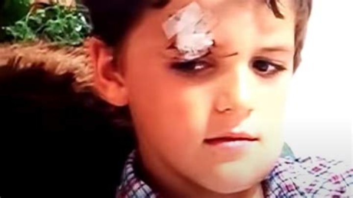 Jacob Roloff Accident: A Comprehensive Look at the Incident and Its Impact