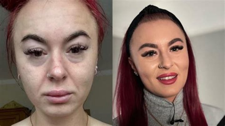 Jessica Dube's Injury: The Before and After