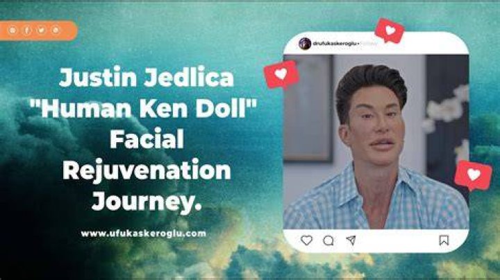 Justin Jedlica: The Human Ken Doll and His Journey Through Cosmetic Surgery