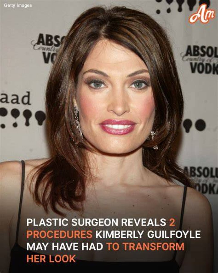 Kimberly Guilfoyle Before and After: A Journey Through Transformation