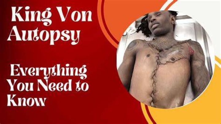 King Von Autopsy Pictures: The Truth Behind the Controversy