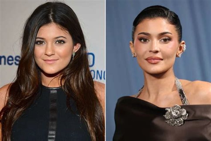 Kylie Jenner and Plastic Surgery: A Comprehensive Analysis