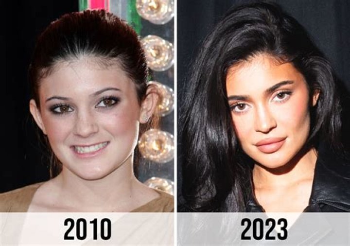 Kylie Jenner Before Surgery: A Comprehensive Look at Her Transformation