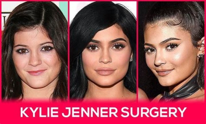 Kylie Jenner Surgery: A Comprehensive Look at Her Transformative Journey