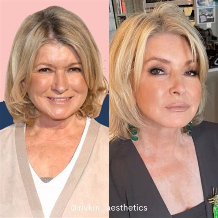 Martha Stewart Plastic Surgery: The Truth Behind Her Transformation