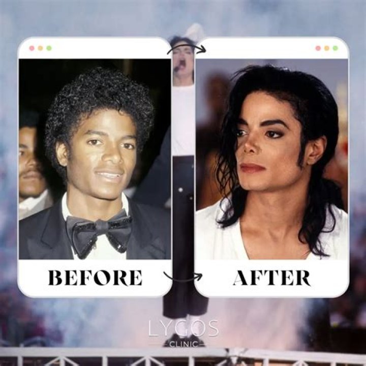 Michael Jackson Before Nose Job: A Deep Dive into His Transformative Journey