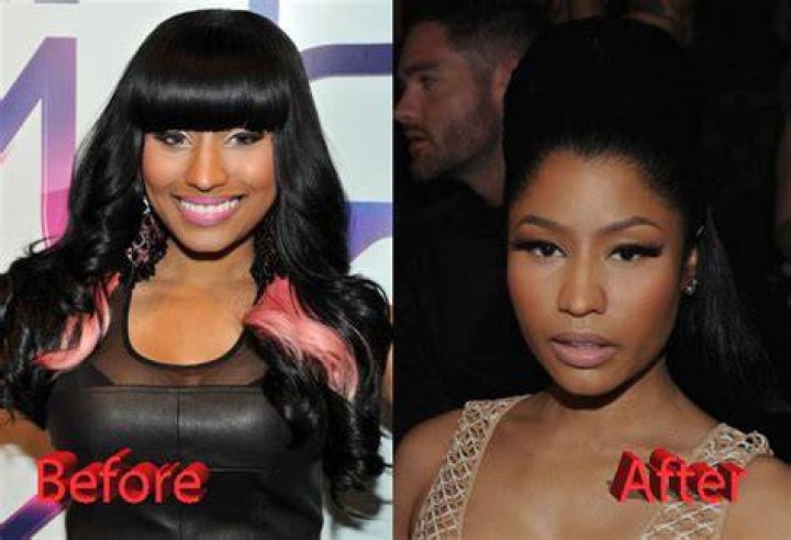 Nicki Minaj Pre Surgery: A Journey Through Transformation