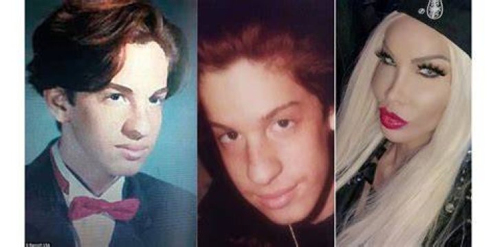 Nikki from 90 Day Fiancé: A Journey Before Surgery