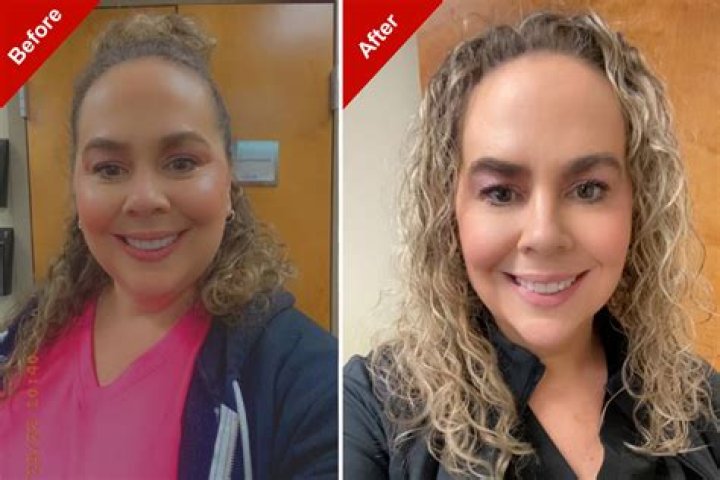 Ozempic Sensation: Woman Stunned by Unforeseen Side Effect