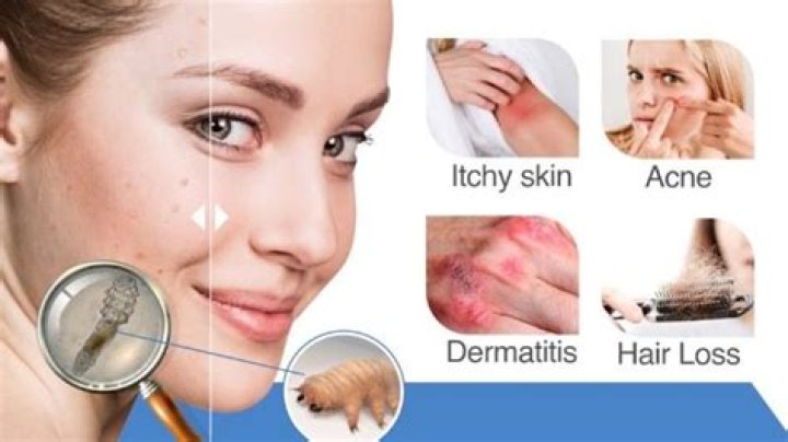 Signs Demodex Mites Are Dying: Understanding Your Skin's Health