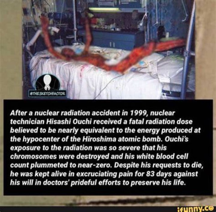 The Harrowing Story of Hisashi Ouchi: A Real-Life Tragedy of Radiation Exposure