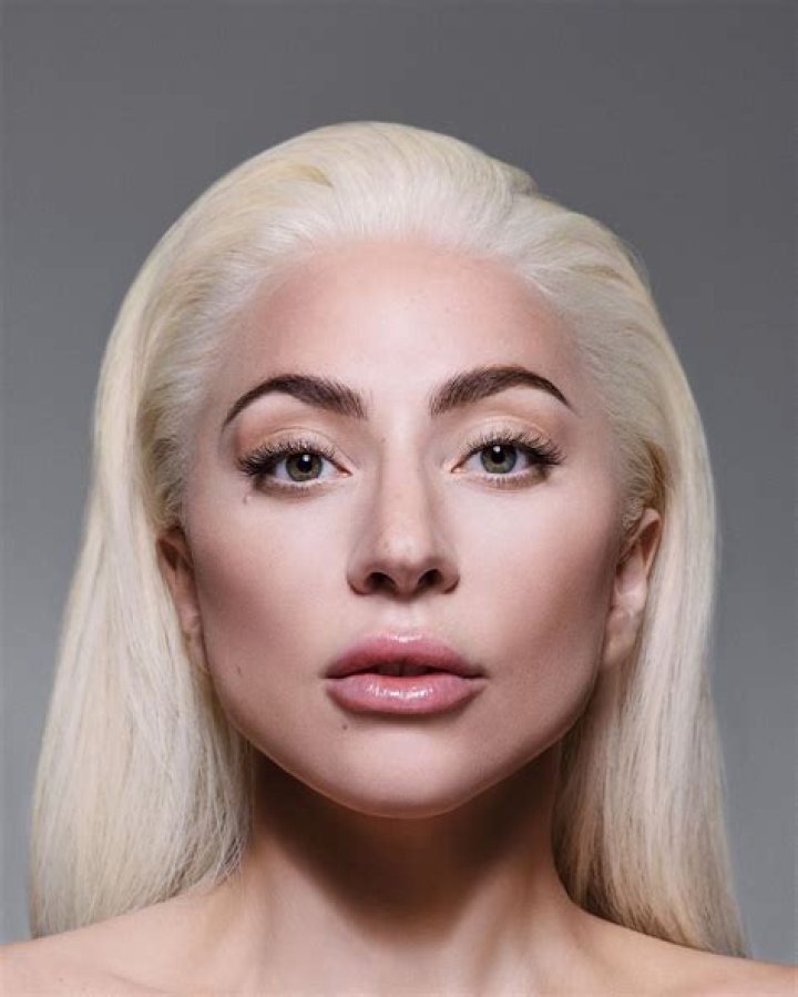 The Inspiring Story of a Black Singer with a Mole on Her Face