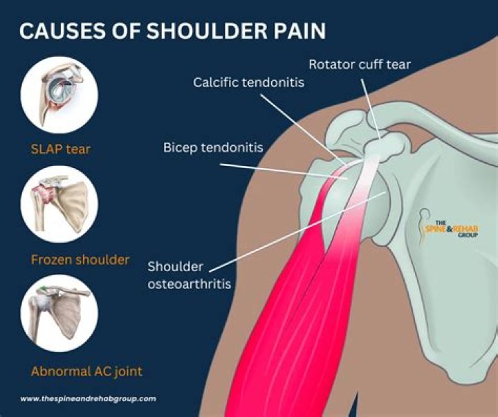 The Intricacies of Royal Painhow: Understanding the Phenomenon