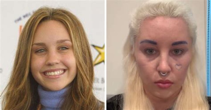 The Intriguing Journey of Amanda Bynes: A Deep Dive into Her Life and Career