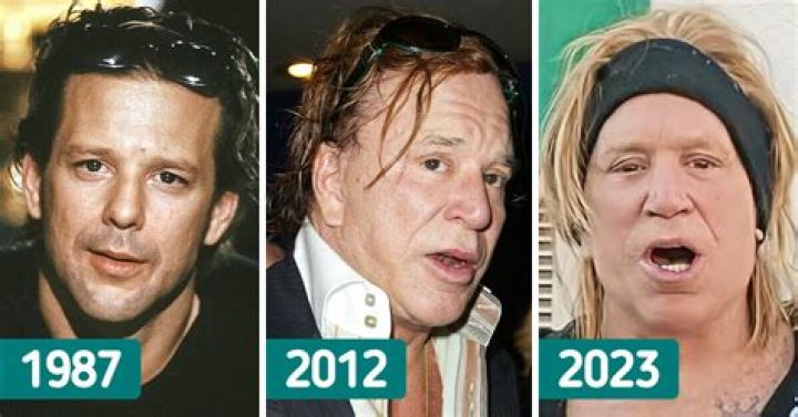 The Shocking Truth: What Really Happened to Mickey Rourke's Face?
