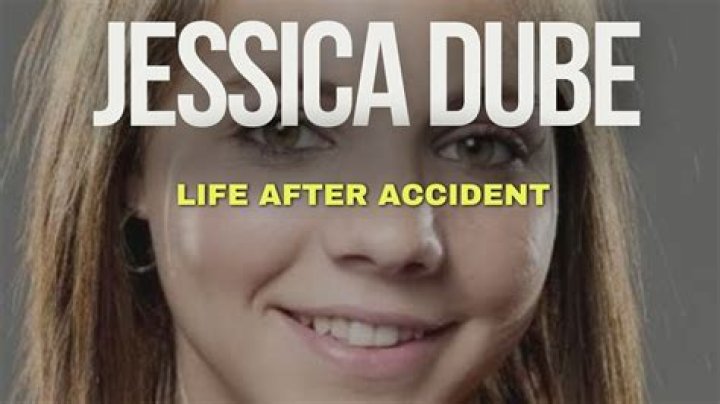 The Untold Truth About Jessica Dube's Devastating Facial Injury