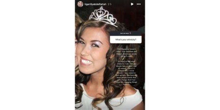 Tigerlily Before Surgery: A Deep Dive into Her Journey
