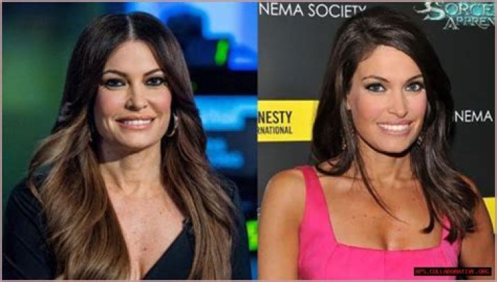 Transformative Journey: Kimberly Guilfoyle Before and After
