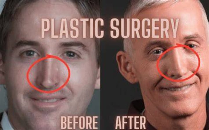 Trey Gowdy Plastic Surgery: Unveiling the Truth Behind the Speculation