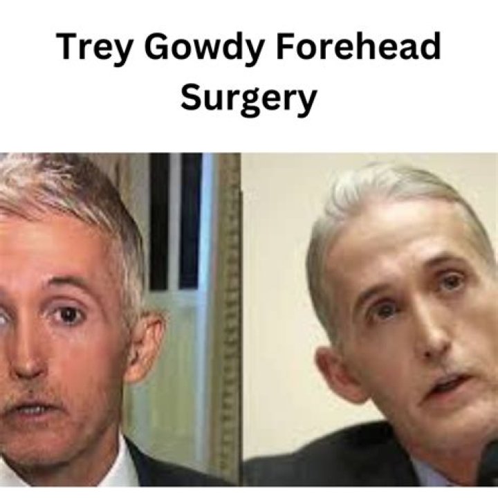 Trey Gowdy: The Controversy Surrounding His Forehead Surgery