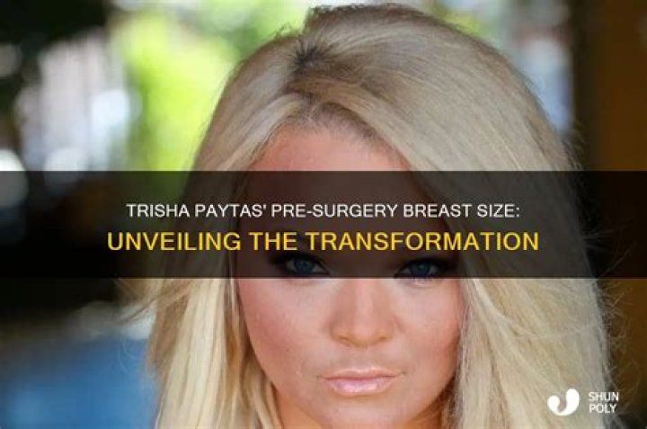 Trisha Paytas Before Surgery: A Deep Dive into Transformation