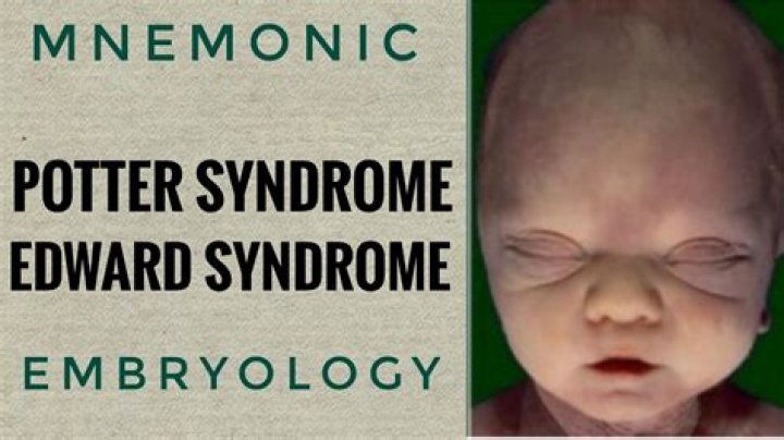 Understanding Edward Bluemel Syndrome: A Comprehensive Overview