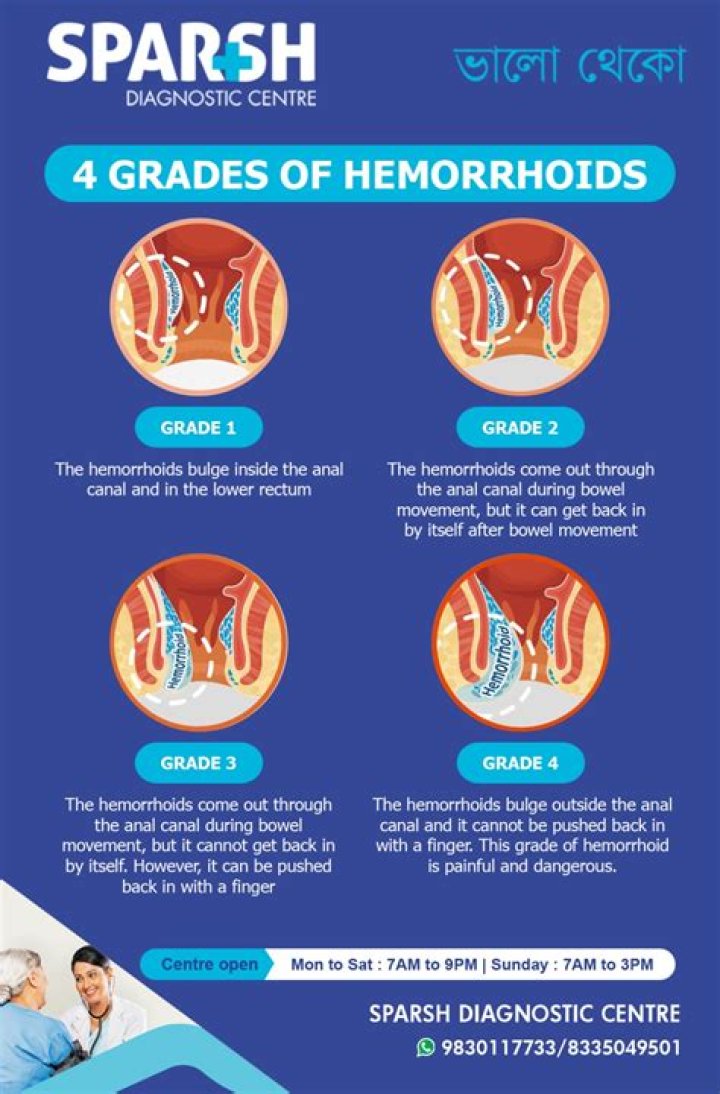 Understanding Hemorrhoids: Do They Smell?