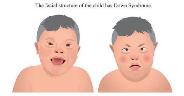 Understanding Hugh Grant's Journey with His Daughter's Down Syndrome